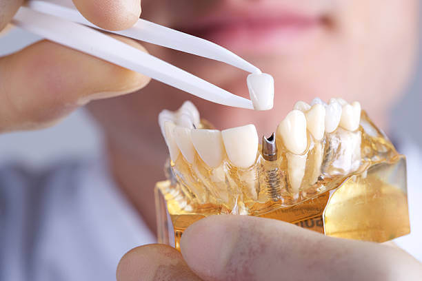 Replace a single missing tooth with dental implants in Waukesha